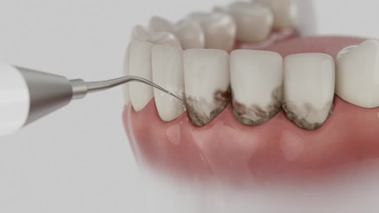 Reliable Dental contractor in Middleton, ID by Smile Center Dentistry